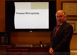 dr mark prysi finesse rhinoplasty naples, florida plastic surgeon